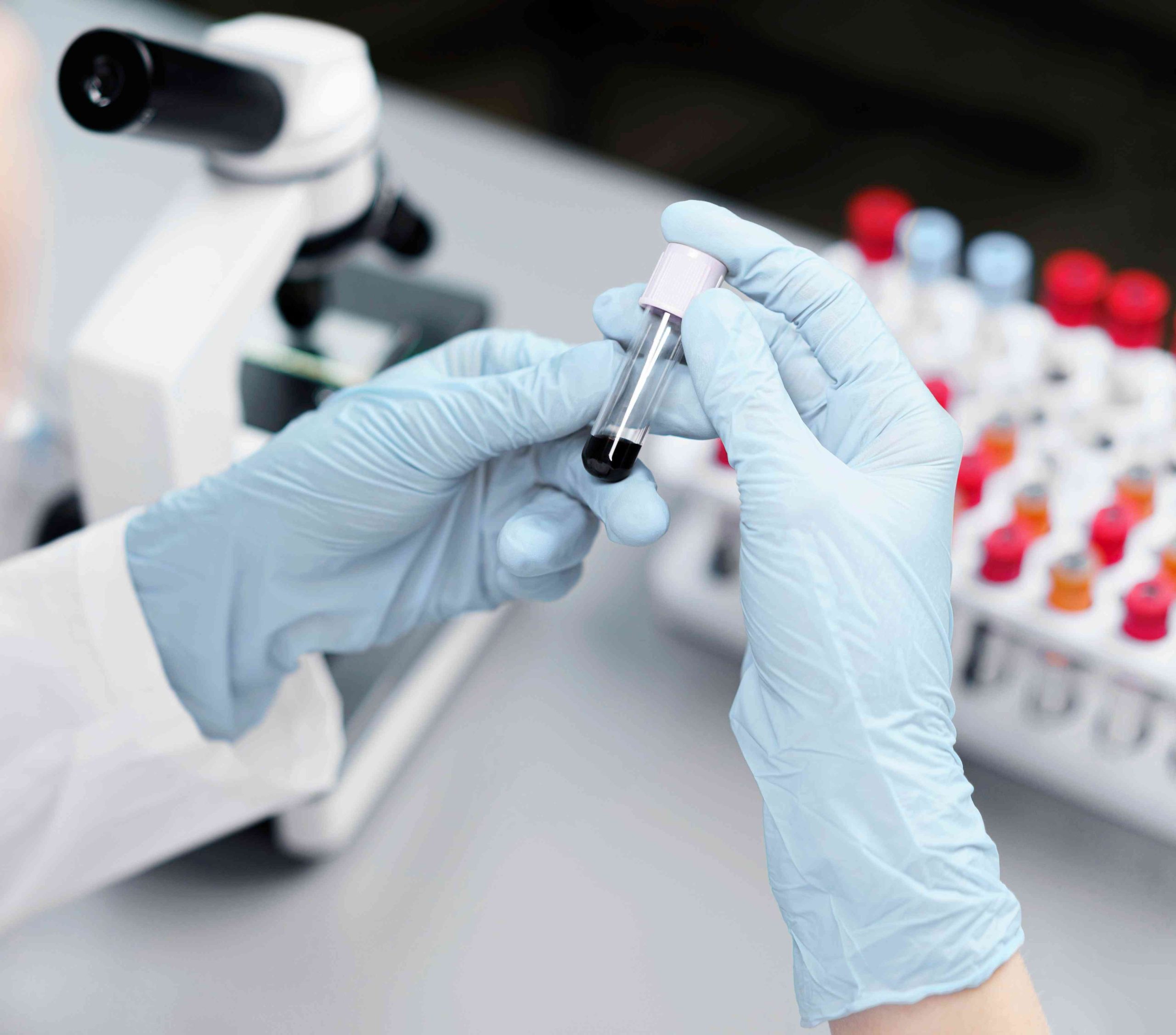 آزمایش خون و cbc _ آزمایشگاه دکتر یاورمنش