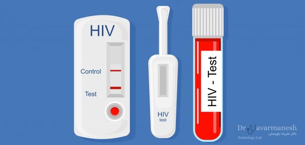 تست سریع hiv- بهترین آزمایشگاه مشهد