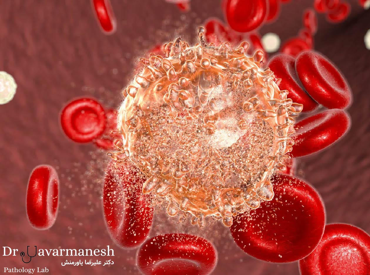 تصویر مفهومی سلول های سرطانی در زیر میکروسکوپ
