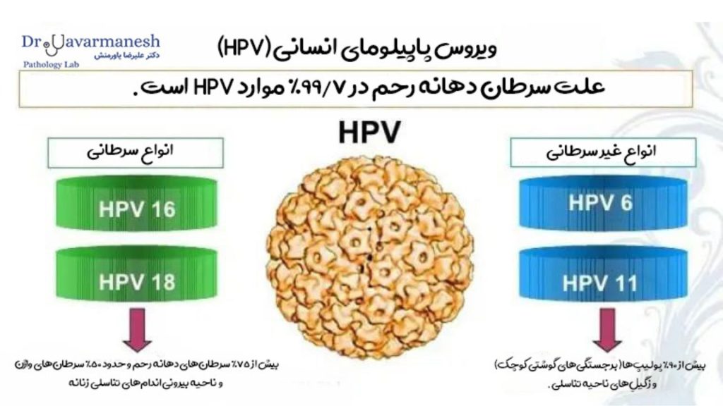 اینفوگراف انواع HPV