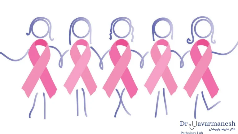 سرطان سینه از شایع ترین سرطان ها در زنان است.