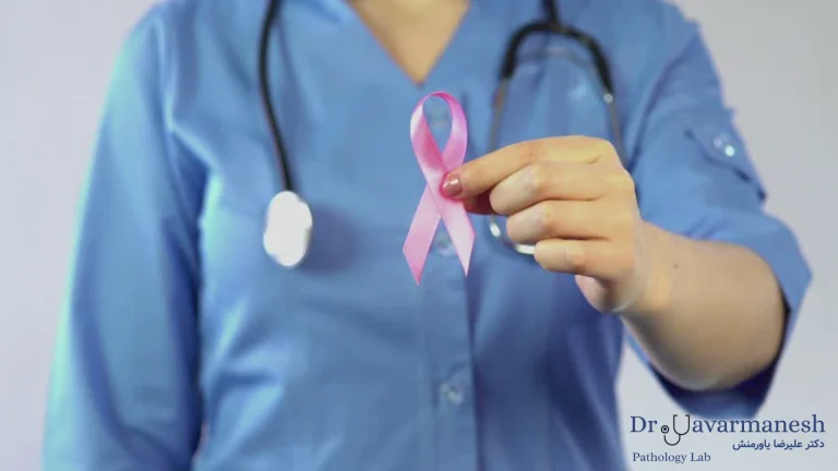 پیشگیری از سرطان سینه