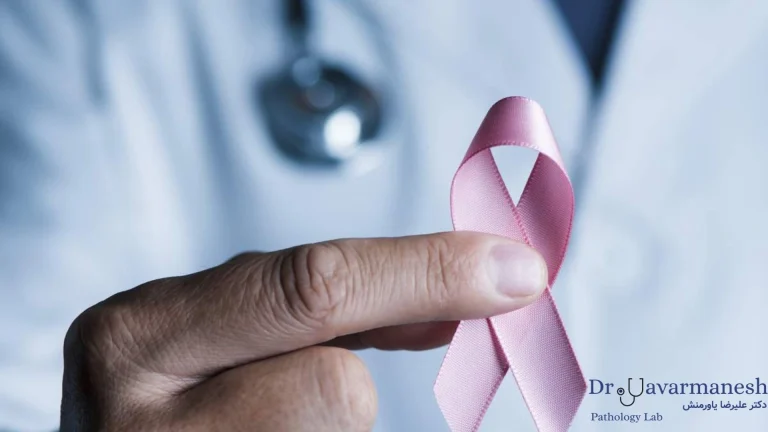 آزمایشگاه دکتر یاورمنش، بهترین آزمایشگاه تشخیص سرطان سینه در مشهد