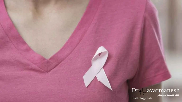 علائم شایع سرطان سینه که نباید نادیده گرفته شوند.