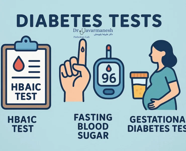 انجام آزمایش HbA1c و اندازه‌گیری قند خون در آزمایشگاه برای تشخیص دیابت