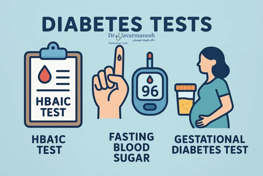 انجام آزمایش HbA1c و اندازه‌گیری قند خون در آزمایشگاه برای تشخیص دیابت