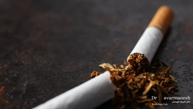 آزمایش قند خون ناشتا برای غربالگری دیابت در افراد سیگاری