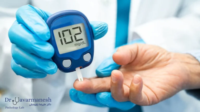 آزمایش HbA1c و بررسی کنترل قند خون در بیماران دیابتی سیگاری